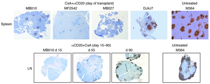 B cell depletion in lymphatic tissues after anti-CD20 therapy.
Spleen an...