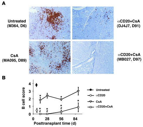 Immunochemistry analysis of graft-infiltrating B cells.
Cardiac graft bi...