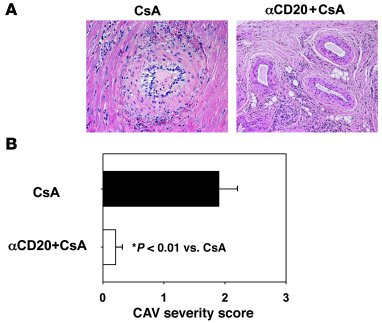 B cell depletion combined with CsA inhibits chronic cardiac allograft re...