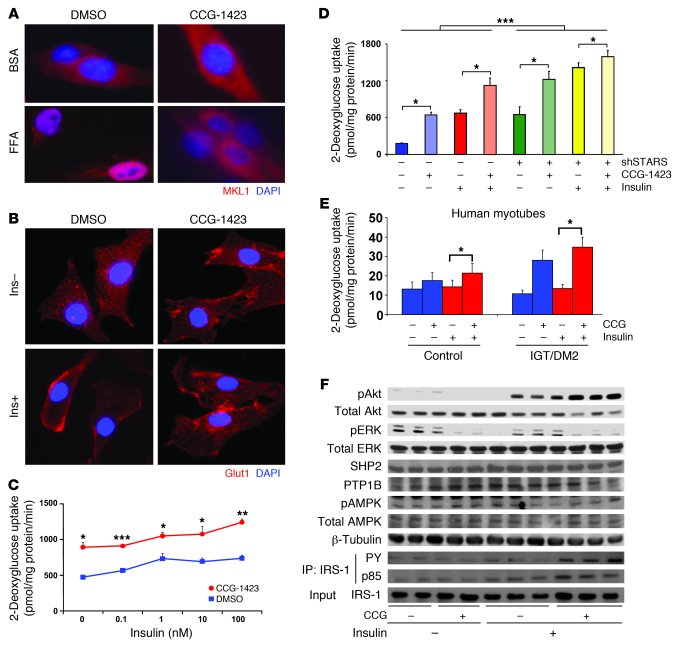 SRF inhibitor CCG-1423 improves glucose uptake and insulin action.
(A) M...