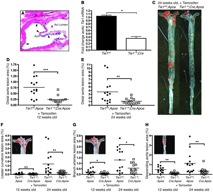 Endothelial-specific Tie1 deletion reduces atherosclerosis burden.
(A) R...