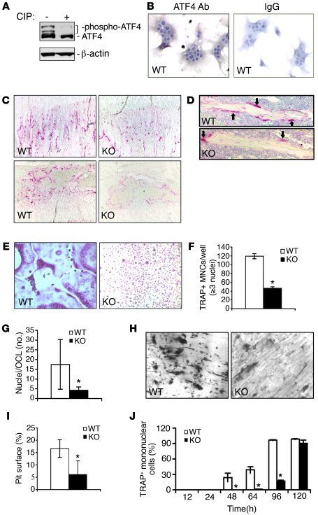 OCL differentiation is dramatically diminished in Atf4–/– BMM cultures a...