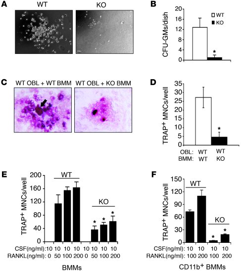 ATF4 deficiency impairs OCL differentiation in a cell-autonomous manner....