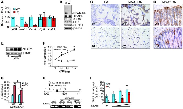 ATF4 regulates NFATc1 expression in BMM cultures and bones.
(A and B) To...