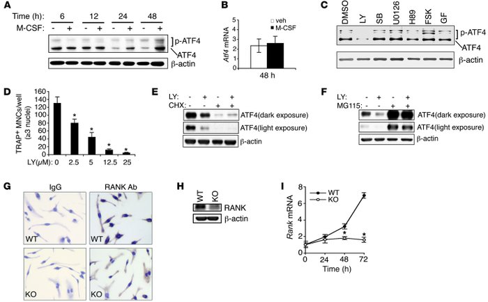 ATF4 is upregulated by M-CSF and PI3K/AKT and is required for M-CSF indu...