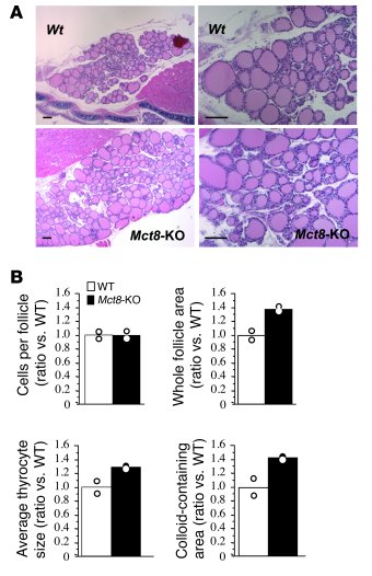 Histology of WT and Mct8-KO mouse thyroid glands.
   
(A) Low- (left) an...