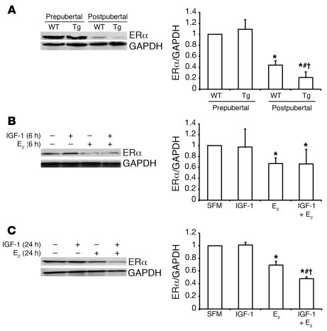 IGF-1 and E2 affect ERα expression in vivo and in vitro.
   
(A) Western...