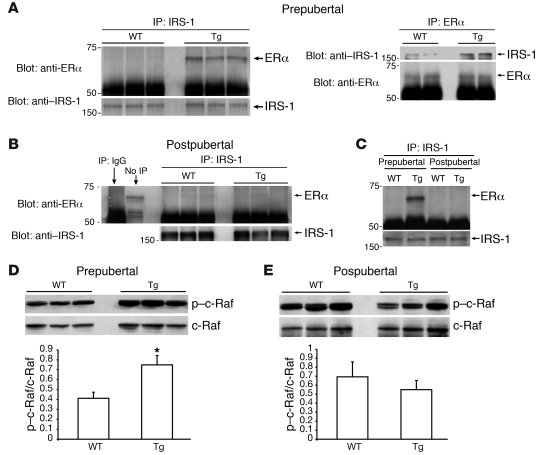 ERα expression levels determine the IGF-1 signal transduction pathway in...