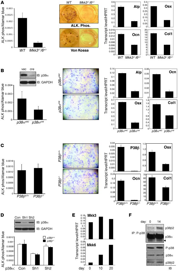 CCD in Tak1osx mice.
   
(A) Sections were taken from the sagittal sutur...