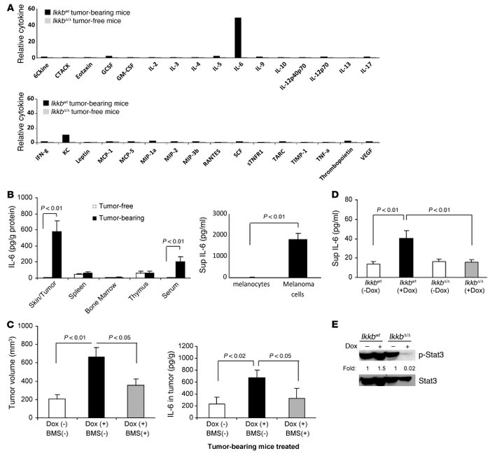 IL-6 is a promoter of melanoma tumorigenesis.
(A) Cytokine profiles were...