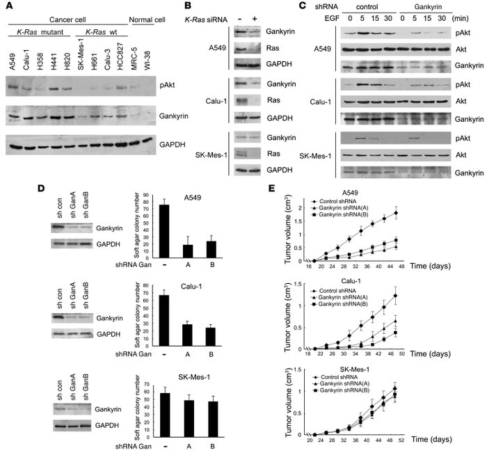Gankyrin is required for the tumorigenesis of human lung cancer cells wi...