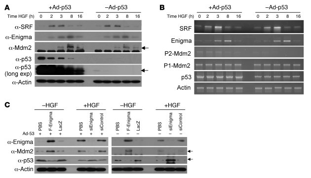 Proliferation signal attenuates p53 by the SRF/Enigma/MDM2 pathway in ce...