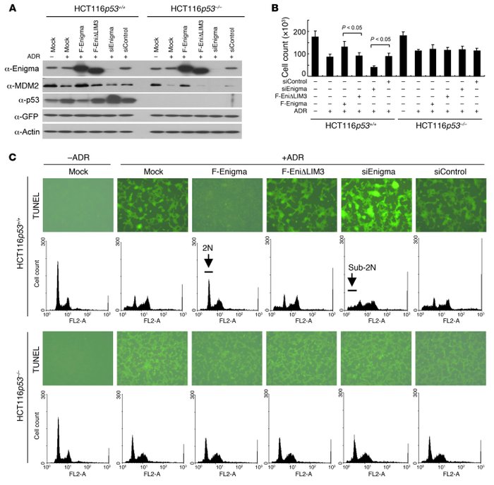 SRF and Enigma are coexpressed with MDM2 in human tumors.
(A) Immunoblot...