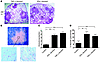 Blocking of TNF-α or IFN-γ leads to development of caseous necrosis within