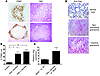 Hypoxia and Ctsg expression is associated with granuloma pathology.