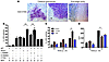 Exogenous CTSG enhances cell death of IFN-γ–activated M. tuberculosis–infec