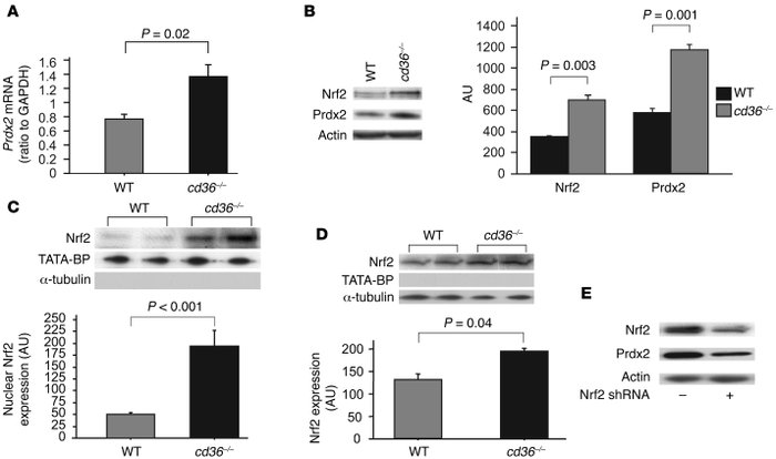 CD36 inhibits Nrf2 nuclear translocation.
(A) Real-time PCR–based Prdx2 ...