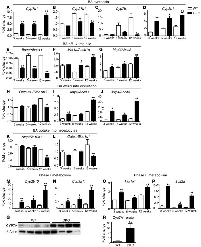 Dysregulation in BA synthesis and transport pathways results in severe c...