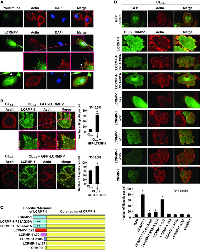 Effects of LCRMP-1 on filopodia formation.
(A and B) Localization of (A)...