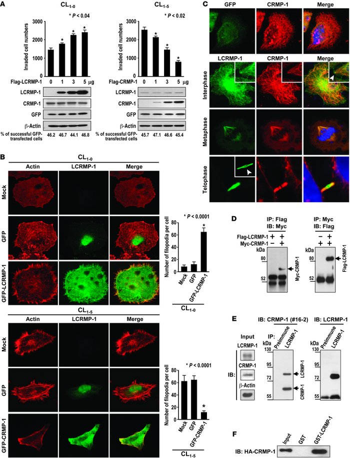 Reciprocal regulation of cancer invasion by LCRMP-1 and CRMP-1.
(A) Less...