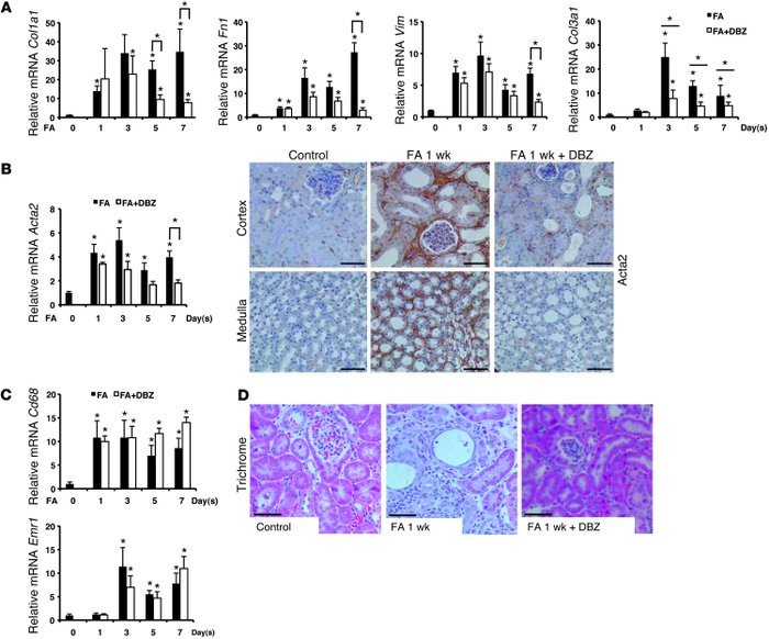 Pharmacological inhibition of Notch signaling ameliorates FA-induced TIF...