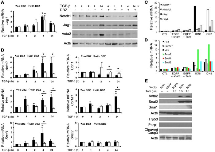 TGF-β1 activates Notch signaling, and Notch plays a role in EMT of cultu...