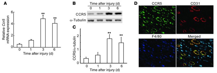 CCR5 expression at wound sites in WT mice.
(A) Quantitative RT-PCR analy...