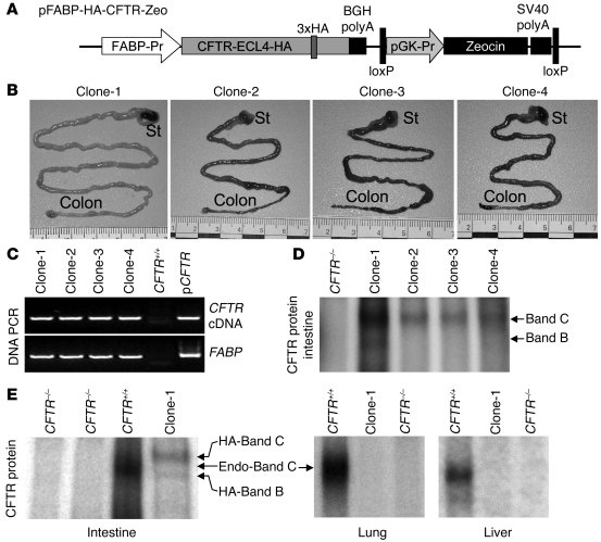 Generation of a gut-corrected transgenic CFTR–/– ferret by SCNT.
   
(A)...