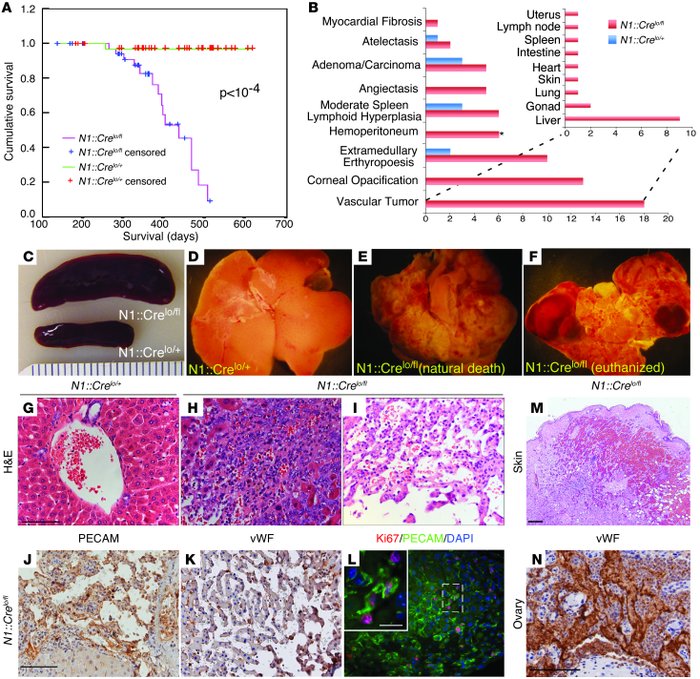 
N1::Crelo/fl mice developed vascular tumors.
   
(A) Kaplan-Meier survi...