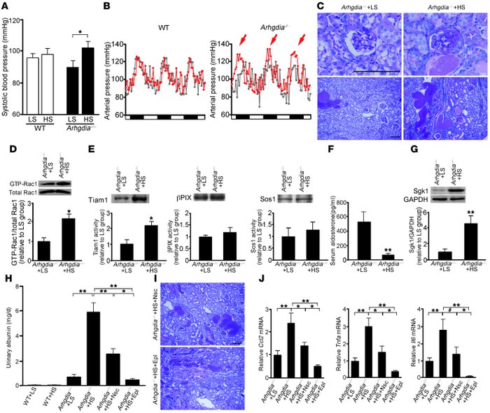 Blood pressure and renal injury in Arhgdia–/– mice are salt sensitive.
 ...