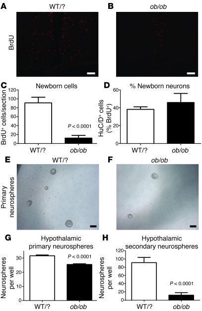 Loss of neural stem cells and neurogenesis in mice lacking leptin.
(A–C)...