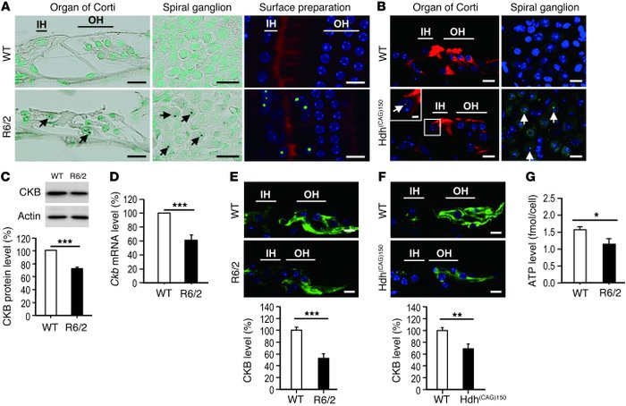 Auditory dysfunction in HD mice.
(A) Cochleae (mid-basal turn) of 10.5-w...