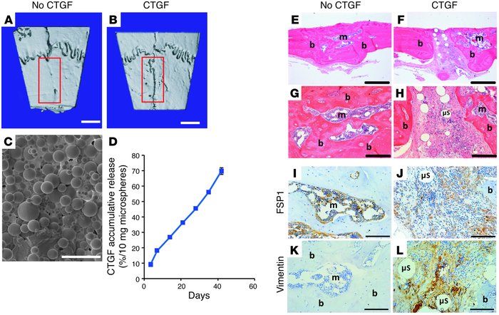 CTGF induced fibrogenesis instead of ectopic mineralization in vivo.
(A ...