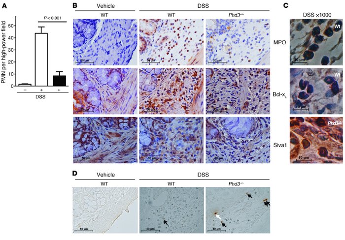 Reduced neutrophilic inflammation in Phd3–/– animals in colitis.
   
Six...