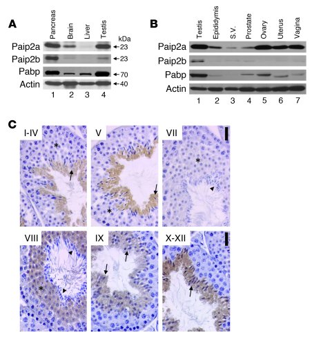 Paip2a and Paip2b expression in mouse.
(A) Tissue distribution of Paip2a...