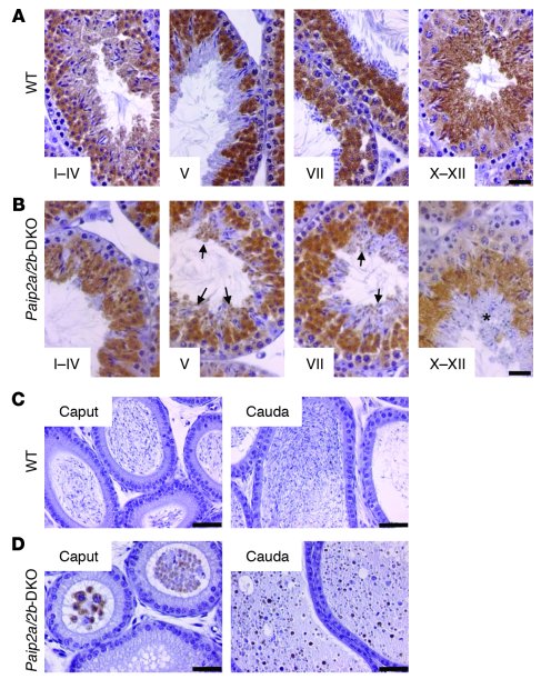 Abnormal Pabp expression in late spermiogenesis in Paip2a/Paip2b-DKO mic...