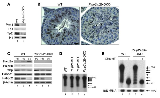 Translation inhibition in late spermiogenesis of Paip2a/Paip2b-DKO mice....