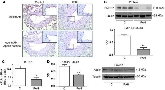 Decreased apelin expression in the endothelium of IPAH patients.
(A) IHC...