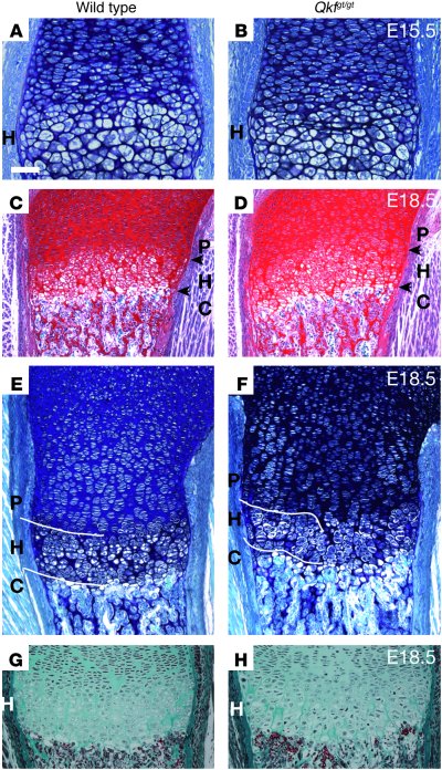 Myst4 deficiency alters growth plate in mice.
(A, C, E, and G) Wild-type...