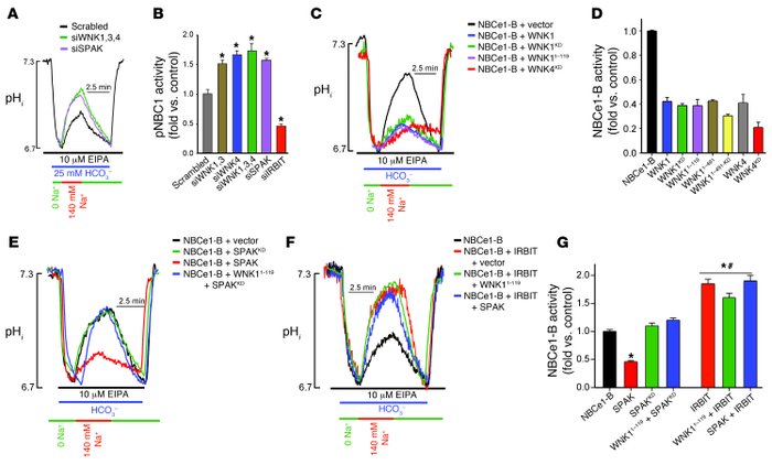 The WNK/SPAK pathway inhibits and IRBIT reverses inhibition of NBCe1-B a...