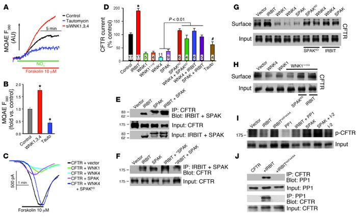 Regulation of CFTR by the WNK/SPAK and IRBIT/PP1 pathways.
(A and B) Sea...