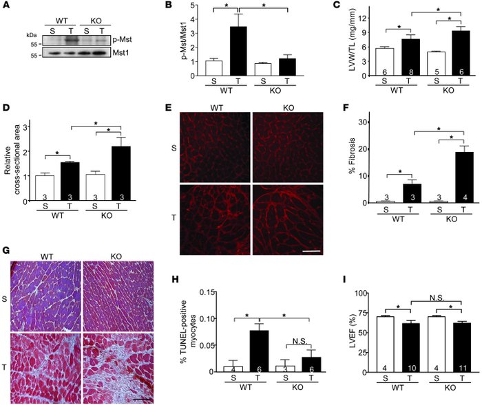 Systemic ablation of rassf1A causes exaggerated stress-induced hypertrop...