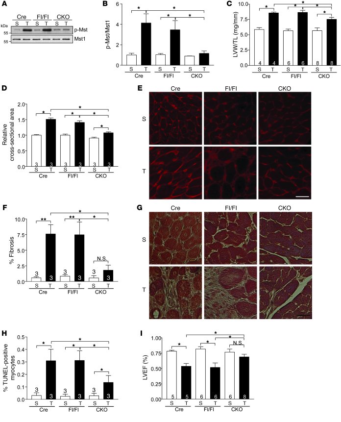 Cardiomyocyte-specific deletion of rassf1A attenuates hypertrophy and fi...