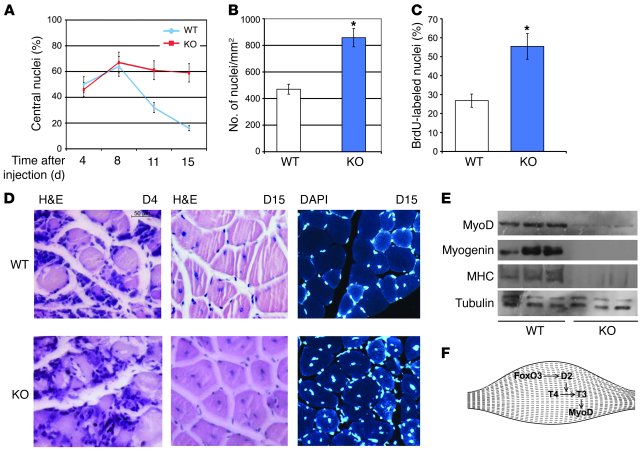 Defective muscle regeneration in Dio2–/– mice.
   
(A) The percentage of...