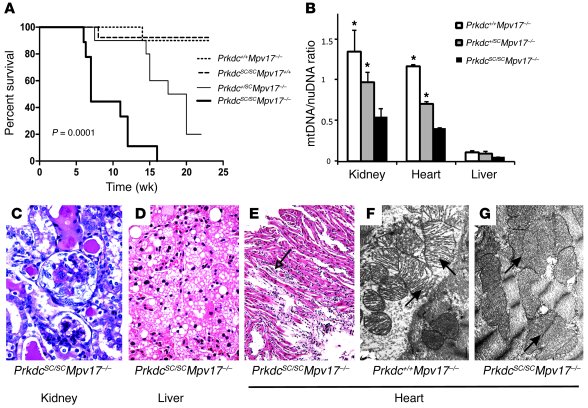 An intercross between Mpv17–/– and PrkdcSCID/SCID mice confirms genetic ...