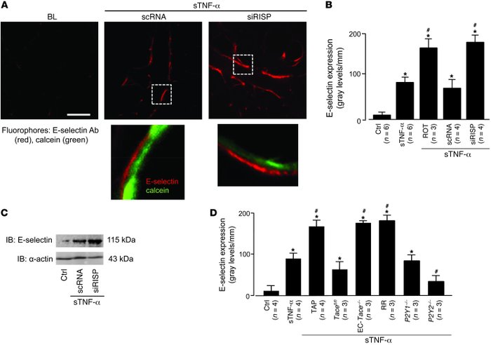 TNFR1 shedding determines lung microvascular E-selectin expression.
(A) ...