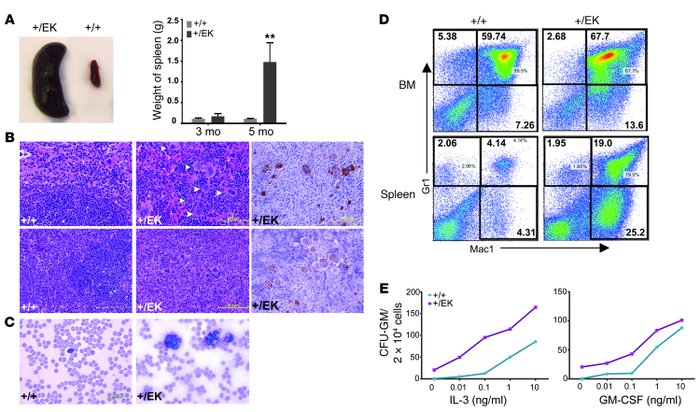 
Sos1+/EK mice develop hematological disorder.
   
(A) Representative vi...