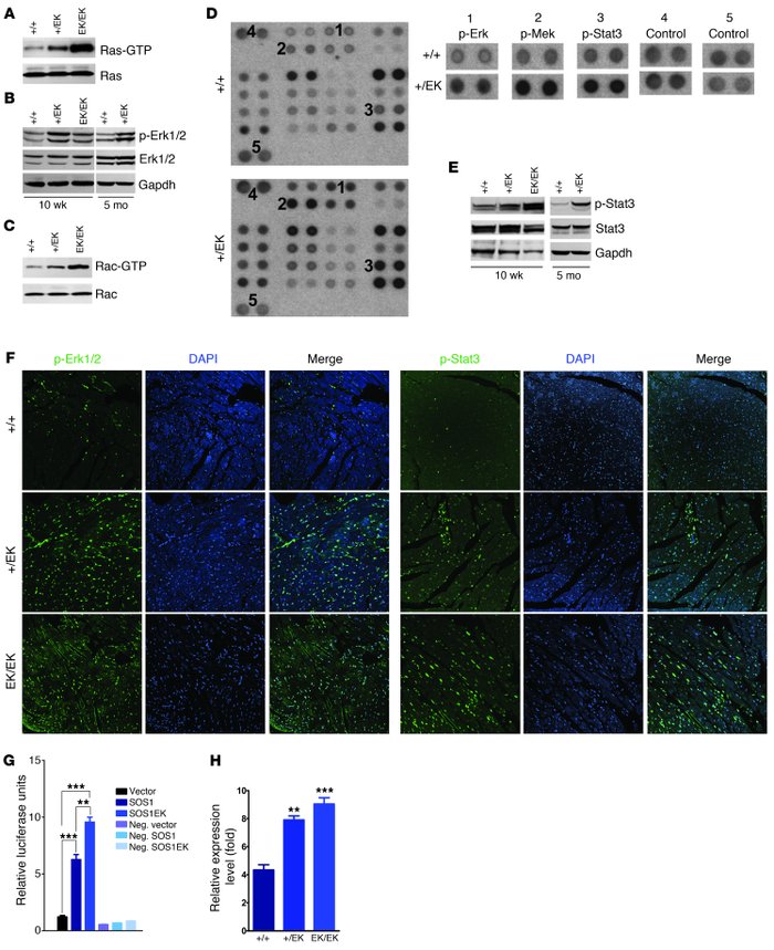 Altered signaling in Sos1EK hearts.
   
(A) Ras-GTP levels are increased...