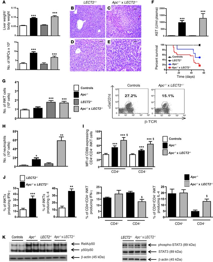 
LECT2 has a critical role in shaping the inflammatory environment in β-...