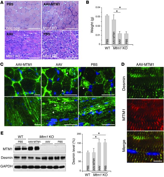 Ectopic expression of MTM1 in Mtm1-KO muscle restores normal desmin expr...